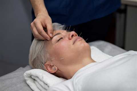 Facelift Acupuncture Training